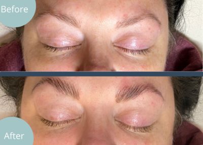 Brow before and after spa serenity